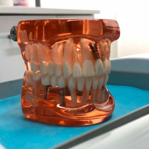 Clínica Dental J. León implantología